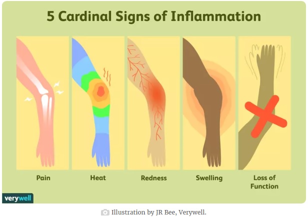 semne ale inflamarii